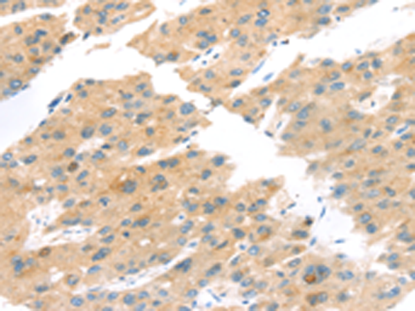 Anti-TNK1 Rabbit Polyclonal Antibody