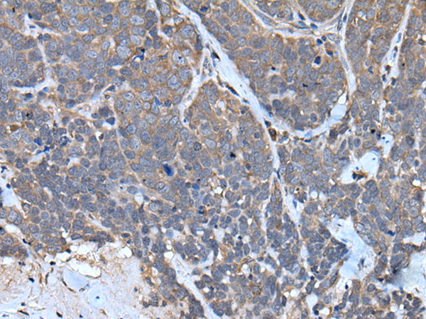 Anti-Tenomodulin Rabbit Polyclonal Antibody