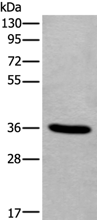 Anti-Tenomodulin Rabbit Polyclonal Antibody
