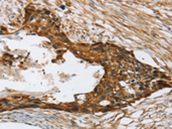 Anti-Tumor Protein D54 Rabbit Polyclonal Antibody