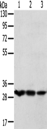 Anti-Tumor Protein D54 Rabbit Polyclonal Antibody