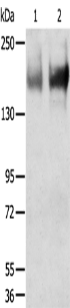 Anti-TRPM6 Rabbit Polyclonal Antibody