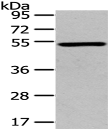 Anti-TSPY Like Protein 1 Rabbit Polyclonal Antibody
