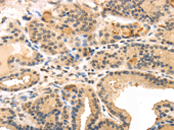 Anti-TRARG1 Rabbit Polyclonal Antibody