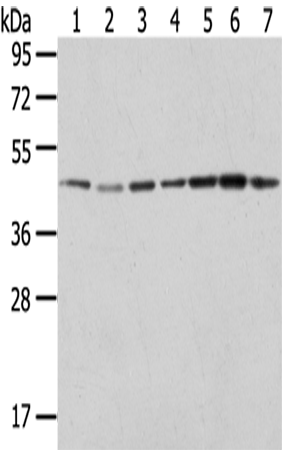 Anti-ER Protein 44 Rabbit Polyclonal Antibody