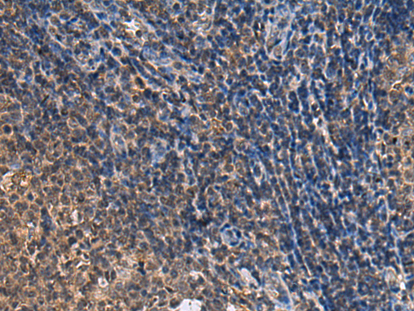 Anti-UBTD1 Rabbit Polyclonal Antibody