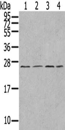 Anti-UBTD1 Rabbit Polyclonal Antibody