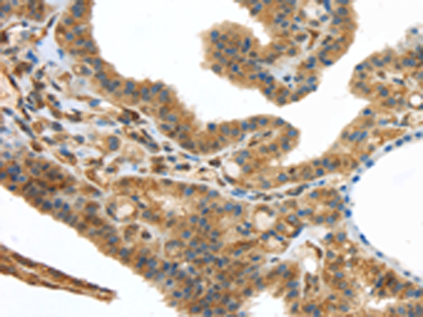Anti-Urotensin 2B Rabbit Polyclonal Antibody