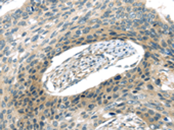 Anti-VAMP2 Rabbit Polyclonal Antibody