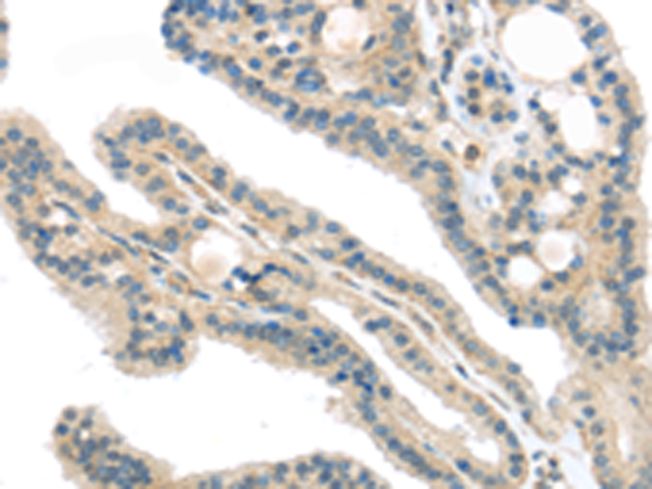 Anti-VPS26 Rabbit Polyclonal Antibody