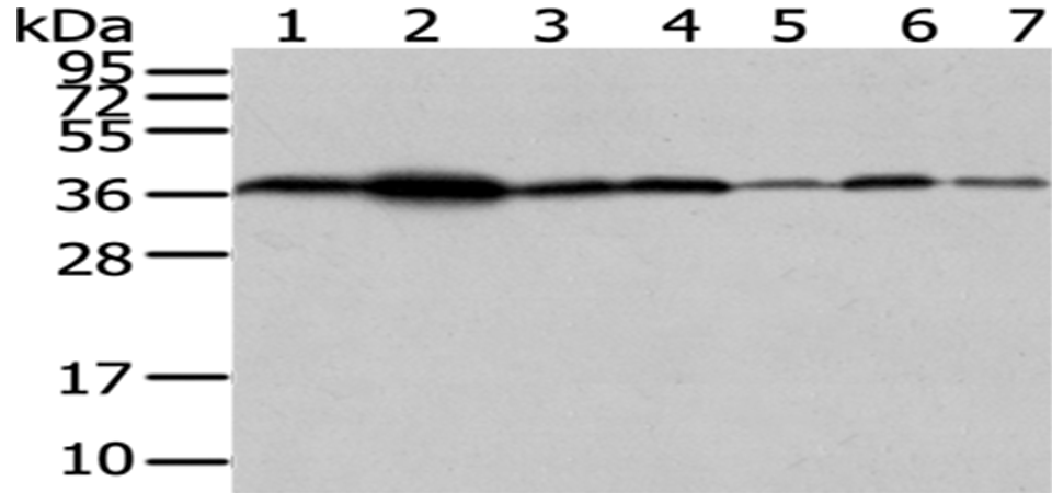 Anti-VPS26 Rabbit Polyclonal Antibody