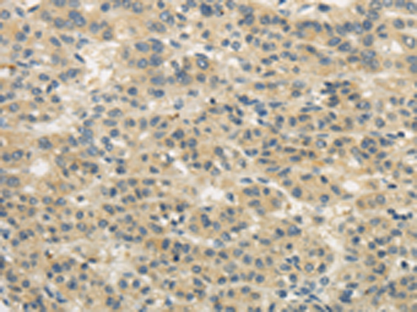 Anti-WDR91 Rabbit Polyclonal Antibody