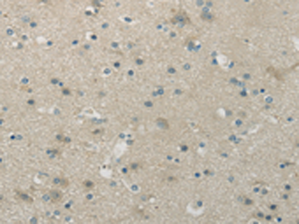 Anti-WNK1 Rabbit Polyclonal Antibody