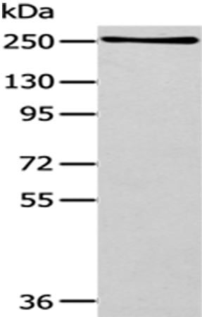 Anti-WNK1 Rabbit Polyclonal Antibody