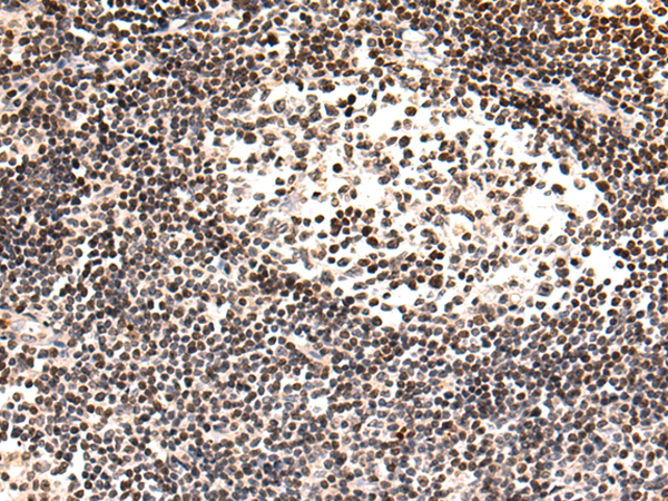 Anti-XIAP Rabbit Polyclonal Antibody