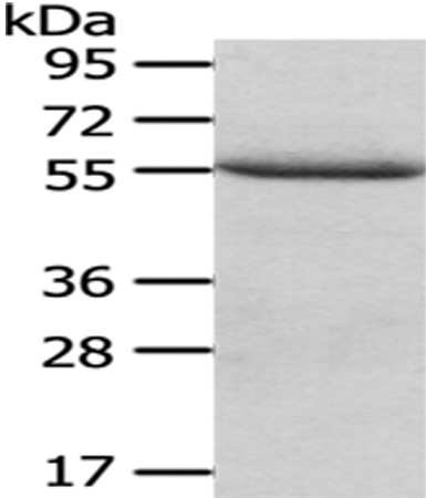 Anti-XIAP Rabbit Polyclonal Antibody