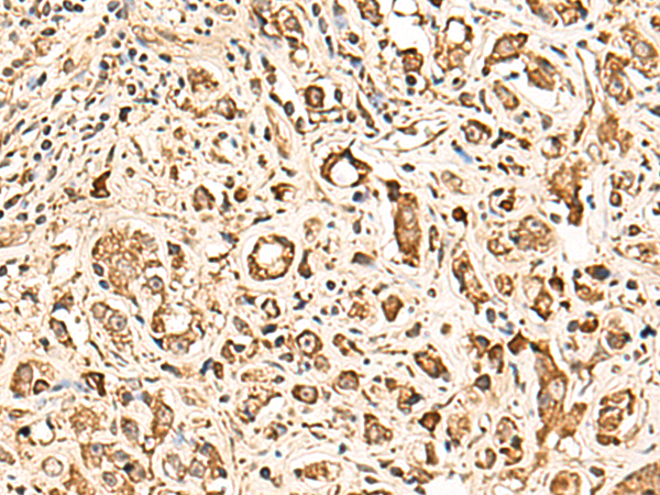 Anti-SOX3 Rabbit Polyclonal Antibody