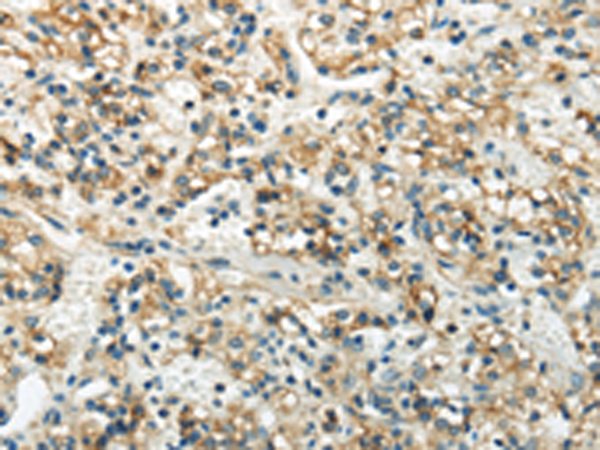Anti-WNK3 Rabbit Polyclonal Antibody