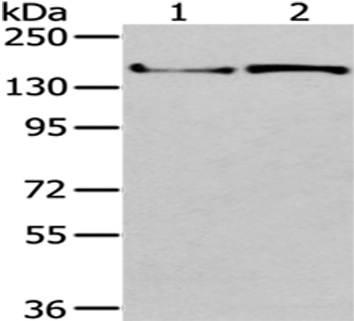 Anti-WNK3 Rabbit Polyclonal Antibody