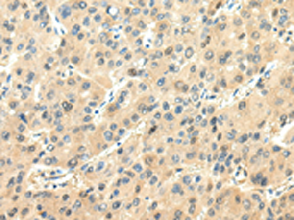Anti-Chromogranin A Rabbit Polyclonal Antibody