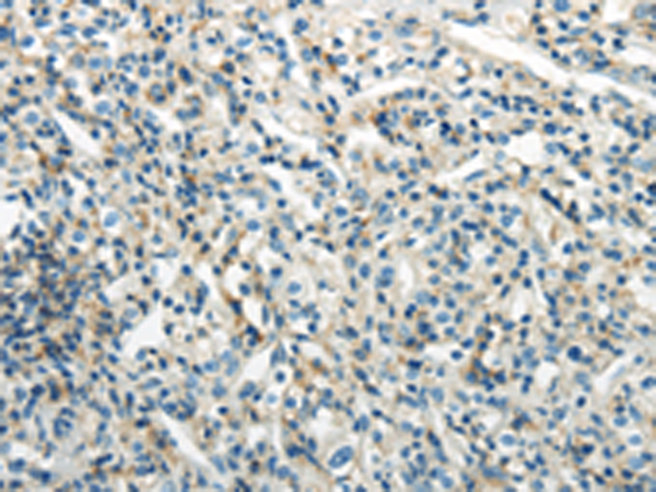 Anti-PDPN Rabbit Polyclonal Antibody