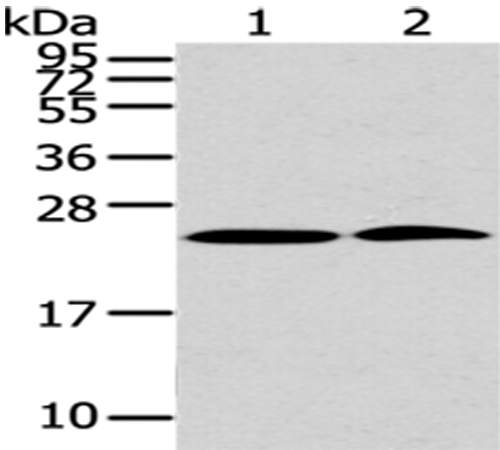 Anti-PDPN Rabbit Polyclonal Antibody