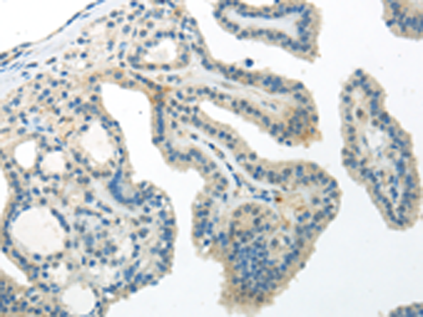Anti-Wnt10a Rabbit Polyclonal Antibody
