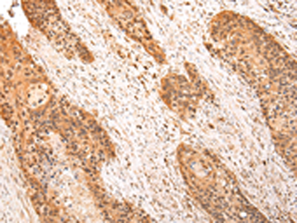 Anti-ZPR1 Rabbit Polyclonal Antibody