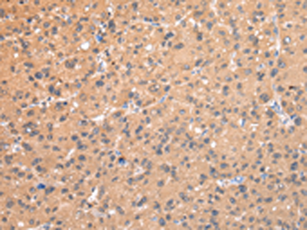 Anti-alpha 1-adaptin Rabbit Polyclonal Antibody