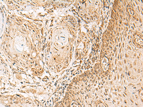 Anti-HNF 1 alpha Rabbit Polyclonal Antibody