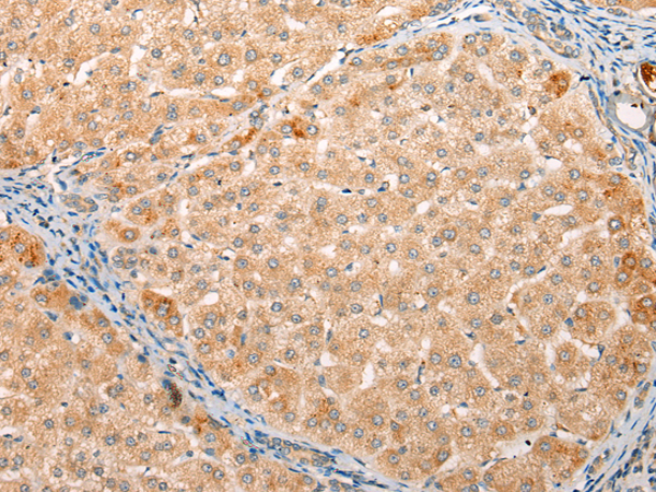 Anti-IRIP Rabbit Polyclonal Antibody