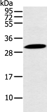 Anti-IRIP Rabbit Polyclonal Antibody