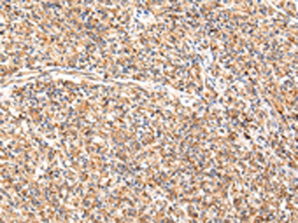 Anti-ADAMTS1 Rabbit Polyclonal Antibody