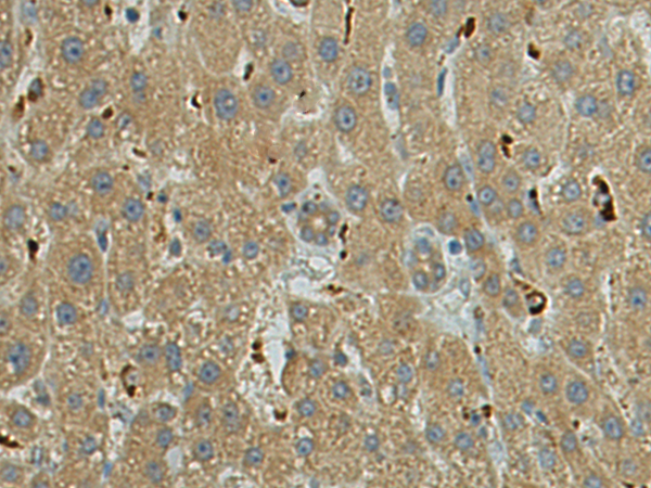 Anti-Cathepsin S Rabbit Polyclonal Antibody