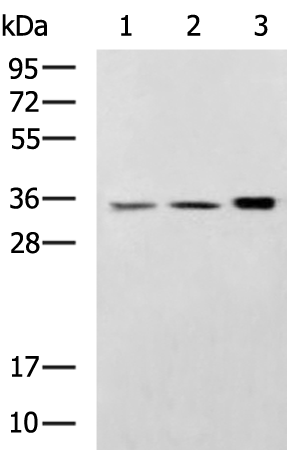 Anti-Cathepsin S Rabbit Polyclonal Antibody