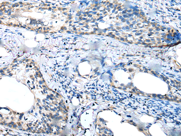 Anti-CCL14 Rabbit Polyclonal Antibody