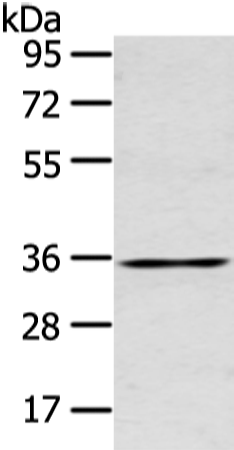 Anti-Gap Junction beta 5 Protein Rabbit Polyclonal Antibody