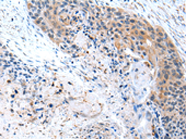 Anti-CFC1 Rabbit Polyclonal Antibody