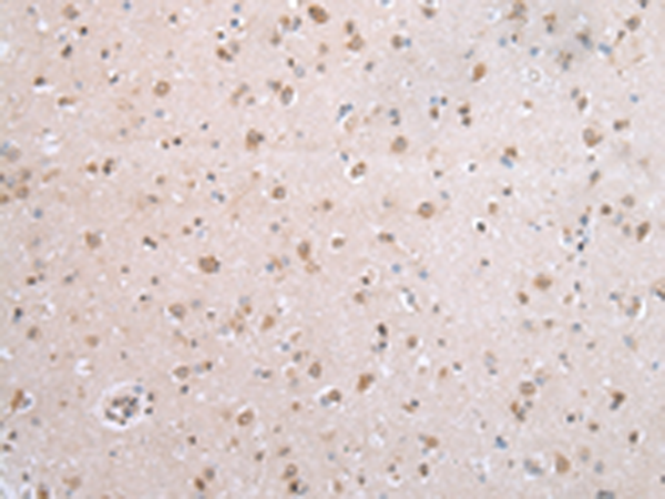 Anti-SUMO Conjugating Enzyme UBC9 Rabbit Polyclonal Antibody