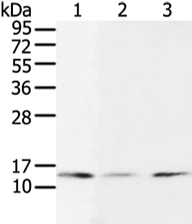 Anti-SUMO Conjugating Enzyme UBC9 Rabbit Polyclonal Antibody