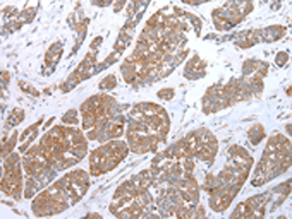 Anti-Claudin 25 Rabbit Polyclonal Antibody