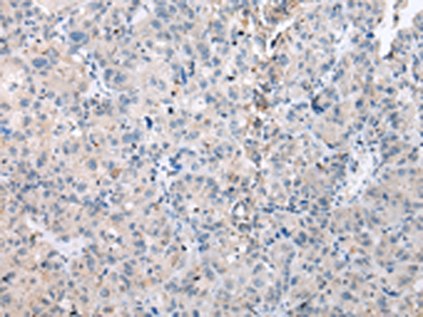 Anti-DUSP9 Rabbit Polyclonal Antibody
