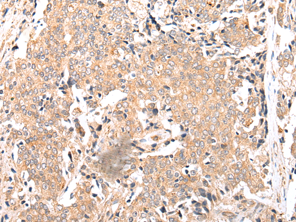 Anti-FPR1 Rabbit Polyclonal Antibody