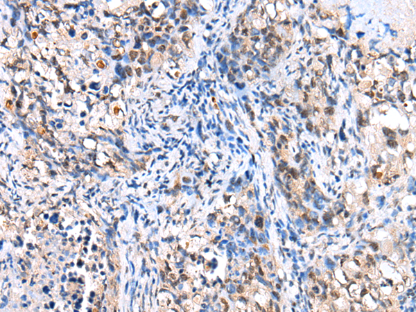 Anti-FOXP4 Rabbit Polyclonal Antibody