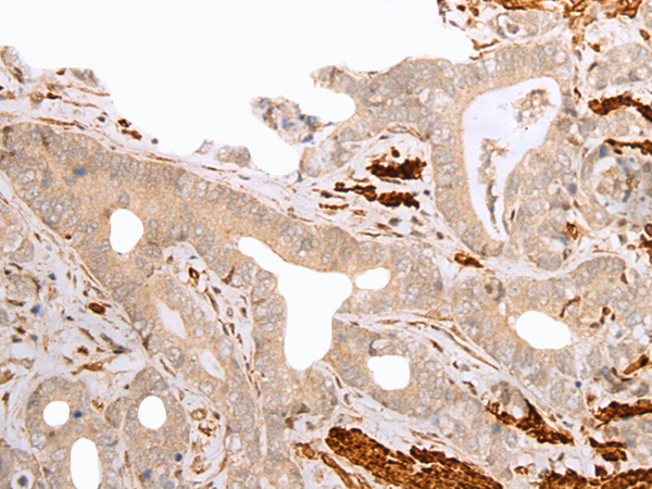 Anti-GFRA4 Rabbit Polyclonal Antibody