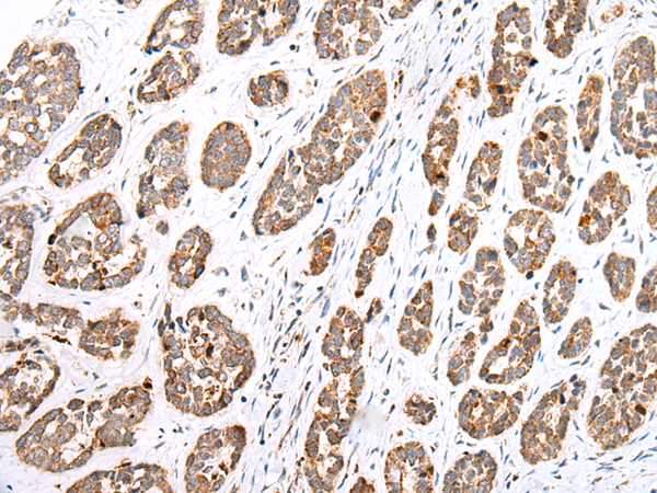 Anti-Glypican 1 Rabbit Polyclonal Antibody