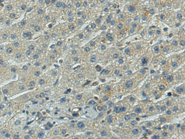 Anti-TNFRSF10A Rabbit Polyclonal Antibody