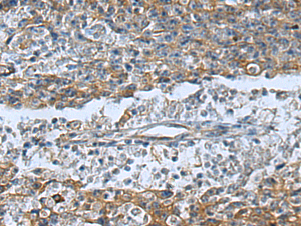 Anti-BMF Rabbit Polyclonal Antibody