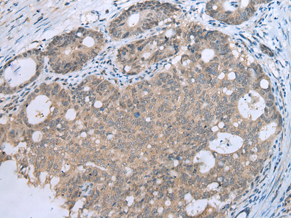 Anti-CCNG1 Rabbit Polyclonal Antibody