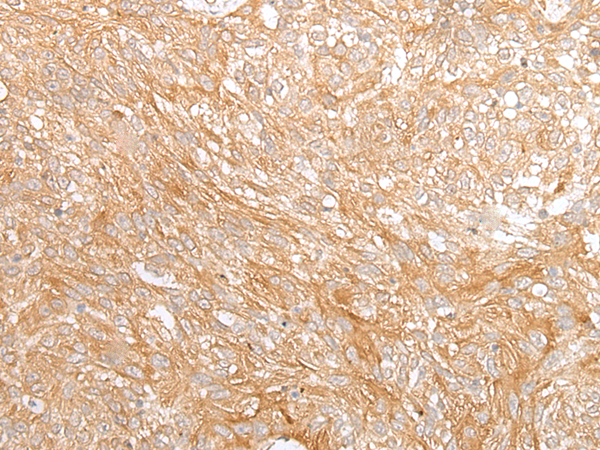 Anti-ADAMTS9 Rabbit Polyclonal Antibody